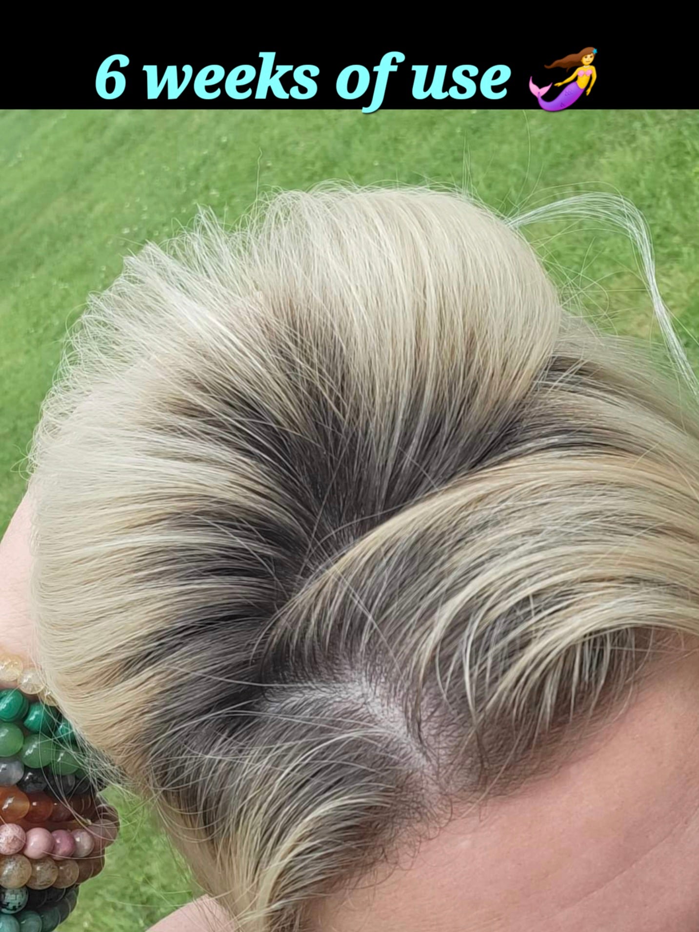 Sea Siren Hair Growth Bundle